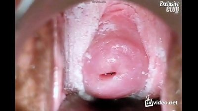 Ayẹwo gynecological ti obinrin lẹwa